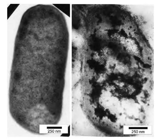Nontreated E. coli (left) and E. coli treated with AP-MgO/Cl2 nanoparticles (right). The dark matter in the right micrograph represents nanoparticles that penetrated inside the cell. 