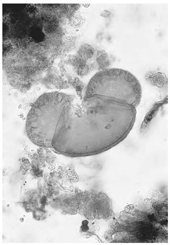 Pollen grain of pine from Mesolithic lake sediment, c. 9000 b.c.  