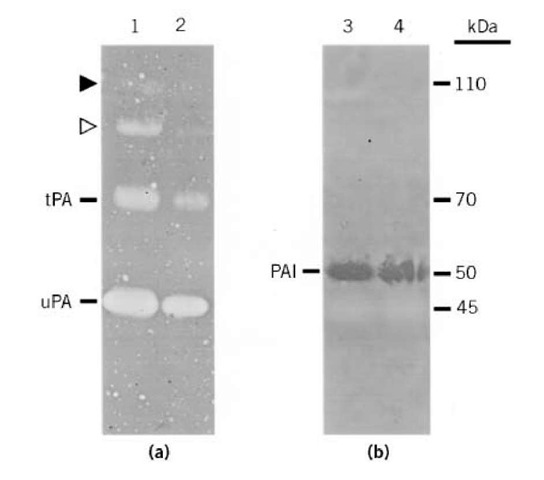 Amido black-stained indicator gels. (a) Fibrin zymogram demonstrating uPA (45 kDa), tPA (70 kDa), and higher molecular weight PA complexes (open and closed triangles). (b) Reverse zymogram demonstrating PAI (50 kDa) as well as uPA shadow (45 kDa). Samples 1-4) were from conditioned media of bovine corneal endothelial cells at different growth stages (4). 