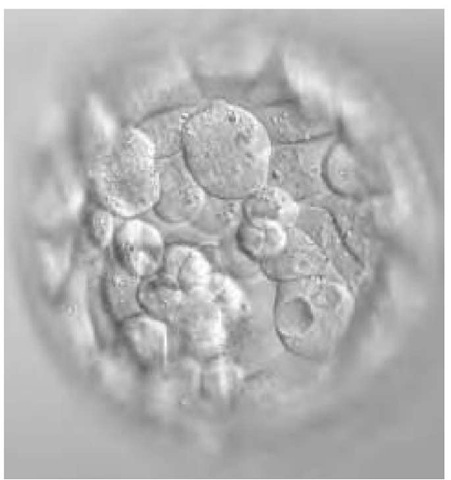 Light micrograph of a human embryo at the blastocyst stage. This early blastocyst is about four days old, appearing as a hollow ball of cells. On around day six, the embryo will begin to implant into the wall of the uterus. Magnification unknown. 