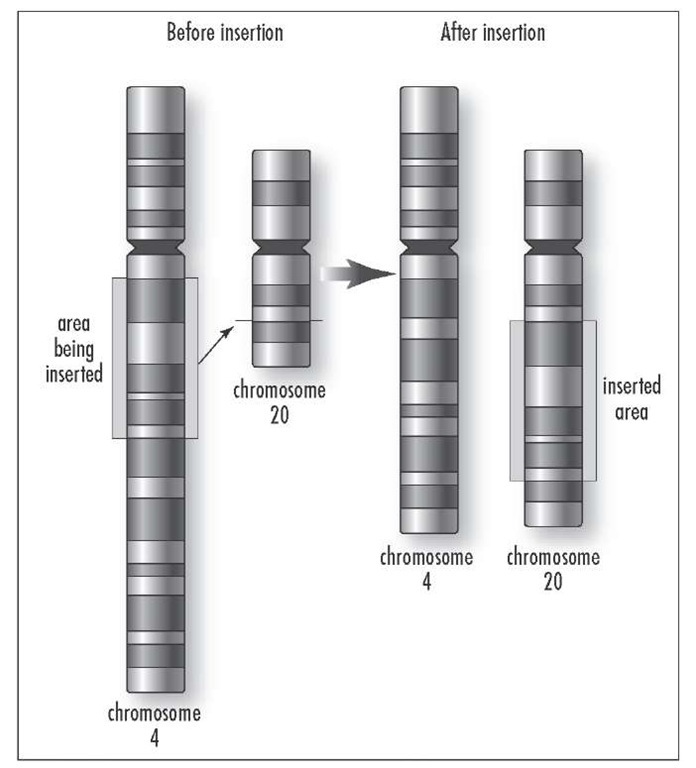 A type of chromosomal abnormality in which a DNA sequence is inserted into a gene, disrupting the normal structure and function of that gene.