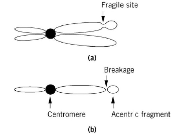  (a) A mitotic chromosome is shown with a fragile site, indicated. (b) Mitosis can create forces that break the chromosome at the fragile site, creating a residual chromosome that contains the centromere and an acentric fragment as indicated. 