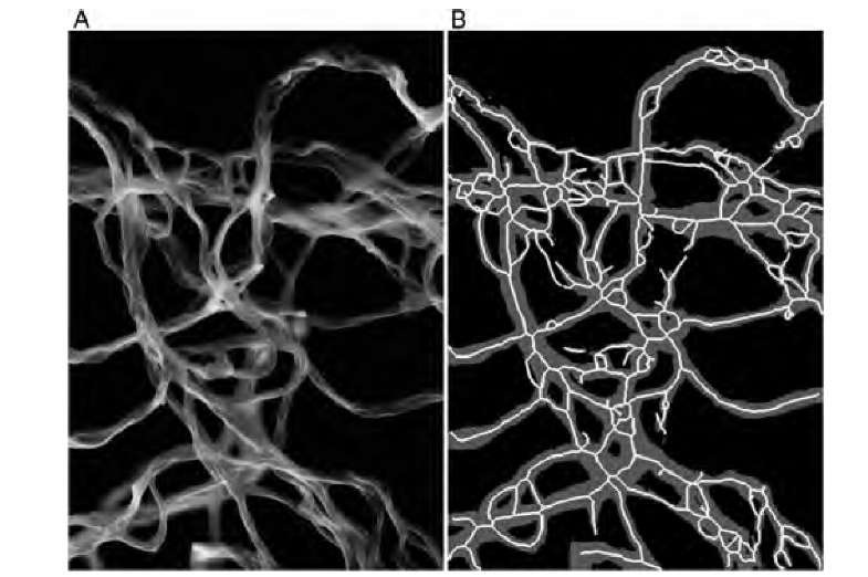  Scanning electron microscope image of collagen fibrils (A). After threshold segmentation, the skeleton can be created (B), where the gray region is the thresholded fibril region, and white lines represent the skeleton. Connectivity, represented by the number of edges and the number of nodes, was higher in the presence of gold nanoparticles. The connectivity reflected the tendency of the fibrils to curl and self-intersect when gold nanoparticles were present.