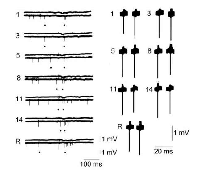  Neuronal responses of the general cortex of turtle to repeated presentation of light flashes and rare stimuli. At the left upper, evoked potentials, lower extracellular activity. Numbers of habitual stimulus are pointed out, R response to the rare stimulus (another light stimulus). The points indicate APs, which are shown at the right: in each frame, at the left- spontaneous AP, at the right evoked AP. The Fig. 1.17 was redrawn in accordance with the data [1266]. 