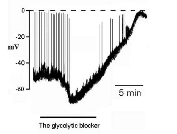 Metabolic disturbance changes electrical activity in an inspiratory neuron in the brainstem-spinal cord preparation of rat. The glycolytic blocker iodoacetate irreversibly abolishes respiratory rhythm and elicits a hyperpolarization, followed by a prominent depolarization. The alterations depend on Ca2+ entry, K+ -channels, Na+ /Ca2+ exchanger functioning, etc. Dotted line indicates zero level of membrane potential, when the cell is near the death. Spike amplitude decrease irreversibly. Calibration in the figure. The Fig.2.1 was redrawn in accordance with the data [81] 