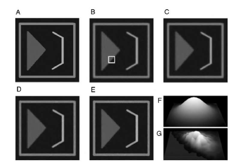 Demonstration of the operation of the adaptive bilateral filter. A test image (B) was created from a synthetic image (A) by performing Gaussian blur and adding Gaussian noise with a standard deviation of 10. The nonadaptive, conventional bilateral filter (£ = 0) already shows good noise suppression while retaining edge contrast (C). Application of the adaptive bilateral filter [£ (x,y) = +A (x,y)] leads to image D, with similarly good noise suppression but an additional restoration of edge sharpness. Image E was created with two successive applications of the adaptive bilateral filter. Images F and G illustrate the composition of the kernel h: the white rectangle in image B indicates the position of the two kernels. Image F is the nonadaptive domain filter kernel, and image G is the adaptive bilateral kernel. It can be seen that the kernel contains zero values on one side of the edge, averaging only values on that side of the edge where the central pixel lies. 