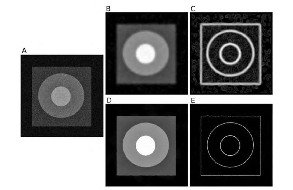 Application of anisotropic diffusion to denoise an image. The original image (A) consists of several areas of different gray values (range 0 to 255) with step transitions and superimposed Gaussian noise with a = 40. Repeated application of strong Gaussian blurring leads eventually to image B, where noise is widely smoothed, but the transitions are blurred, too. As a consequence, the application of an edge detector (Sobel operator) on image B yields fairly broad edges with considerable background texture (C). Anisotropic diffusion (10 iterations, K = 50 followed by 300 iterations, K = 12) not only removes the noise component completely but also preserves the step edges (D). The application of an edge detector on image D results in sharp edges that are only minimally distorted (E). 