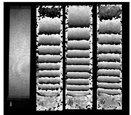  Mild steel cantilever fringe pattern results, i) simple image of cantilever, ii) annealed sample result, iii) residual stress result, iv) peened sample result. 