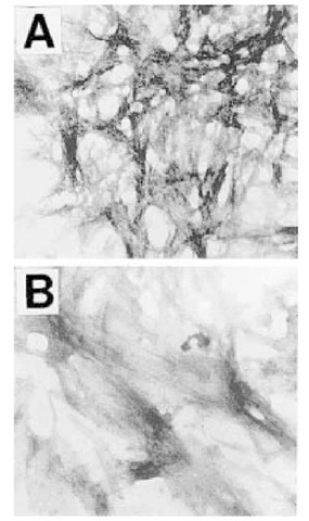 Fibrils of PrP. Electron microscopic photomicrographs of peptides prepared in phosphate-buffered saline and stained with PTA to produce shadowing. (A) PrP106-126. (B) AGAAAAGA. These findings make the peptide AGAAAAGA the shortest known fibrillar peptide. Magnification was x50,000. 