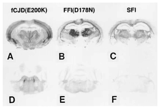 The regional distribution of PrPSc in Tg(MHu2M)/Prnpo/o mice inoculated with brain extracts from fCJD(E200K), is different than that caused by inocula from FFI(D178N) and SFI. Histoblots of coronal brain sections at the level of the thalamus and hippocampus (A,B,C) and transverse sections of the upper pons-lower midbrain (D,E,F) were immunostained specifically for protease-resistant PrPSc. (A,D), fCJD(E200K); (B,E), FFI(D178N); and (C,F) SFI. 