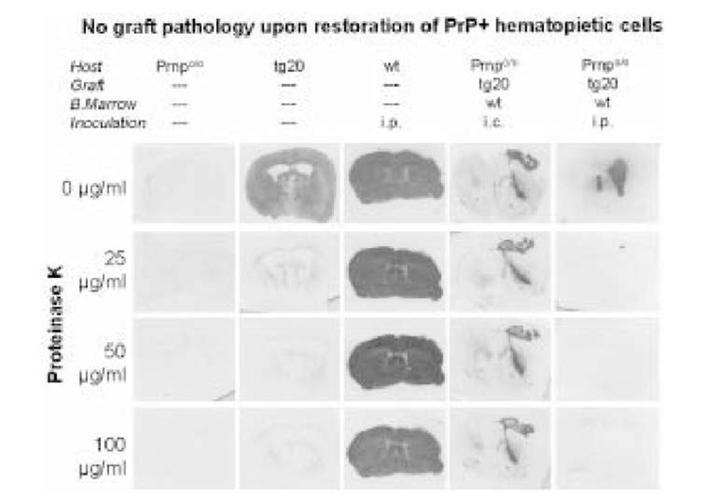 Accumulation of PrPSc in brain grafts. Histoblots showing immunoactive PrPc in brain sections natively (first row) and after digestion with increasing levels of proteinase K (PK) (second through fourth row). Prnp% mice (first column) show no immunoreactivity; mock-inoculated tg20 mice (which overexpress PrPC) show PK-sensitive PrPC (second column), but no PK-resistant PrPSc. Terminally sick scrapie-nfected wilde-type mice contain large amounts of both PrPC and PrPSc (third column). Prnp%, whose bone marrow has been reconstituted with wild-type FLCs, accumulate PrPSc in their PrPC, overexpressing grafts after ic (fourth column), but not after ip prion administration (fifth column). 