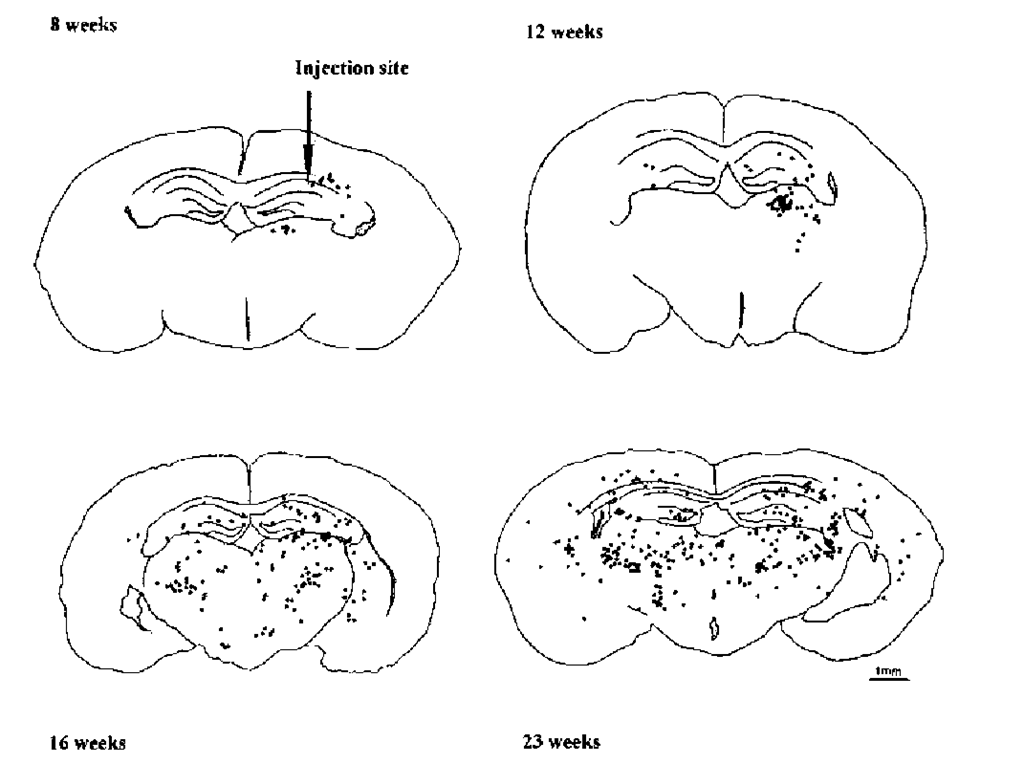 The natural history of T-cell distribution in murine prion disease. Diagram illustrating the progress of CD8+ T-cell distribution at the different survival times indicated, following the injection of ME7 brain homogenate. The representative coronal sections at the level of the injection site were drawn using a microscope drawing tube. Each drawing shows the distribution in a single 10-^m section; each dot represents the location of one CD8+ T-cell. This distribution of CD8+ T-cells is similar to that of activated microglia at corresponding time-points during the course of the disease. 
