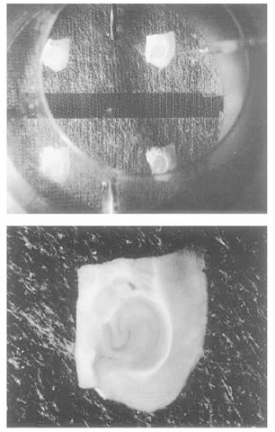 Brain slice recording chamber. The top panel shows four horizontal slices of mouse hippocampal formation in an interface-type recording chamber. The slices lay on strips of lens-cleaning tissue that are about 1 cm wide, which in turn rest on a mesh of tensioned stocking. They are surrounded by a humidified mixture of 95% oxygen and 5% carbon dioxide. The artificial cerebrospinal fluid (ACSF) enters via the stainless steel tubes seen at the top and the bottom of the picture, and is carried away, by the capillarity of the lens tissue, to an annulus that surrounds the stocking at a lower level. From here, it is sucked from the bath. Flow rates in this chamber are typically 0.1 mL/ min (for each side), but are adjusted to ensure that pools of ACSF do not collect around the slice or on the lens tissue. The ACSF is warmed before entering the chamber, which itself sits above a thermostatically controlled water bath. The slices are covered by a lid, which has an aperture to admit the recording (and in some experimental situations, a stimulating) electrode. In this example, the recording electrode is entering at the top right of the picture, and its tip enters the slice in the subiculum. The bottom panel demonstrates that, even in a slice of living, unstained brain 400 ^m thick, the subregions of the hippocampal formation can be distinguished easily. 