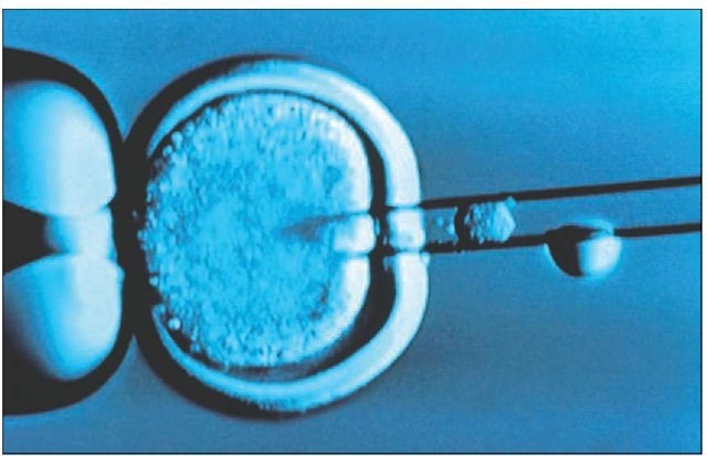 Cloning technique. Light micrograph of a sheep egg being injected with an embryonic cell during sheep cloning. The egg (at center) has had its DNA genetic material removed. At left a pipette holds the egg; at right a microneedle injects an embryonic sheep cell into it. The implanted egg is then stimulated to grow into a lamb by a spark of electricity, nourished in the womb of a surrogate sheep. In 1996 this research at the Roslin Institute in Edinburgh, Scotland, produced the world's first cloned (genetically identical) sheep.