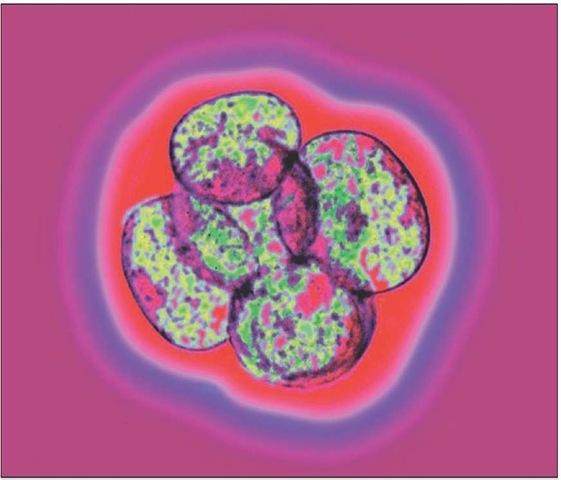 Micrograph of a human embryo soon after fertilization. The cells, or blastomeres, result from divisions of the fertilized egg and are surrounded by the protective zona pellucida layer. The cells of embryos like these are sometimes harvested as stem cells.