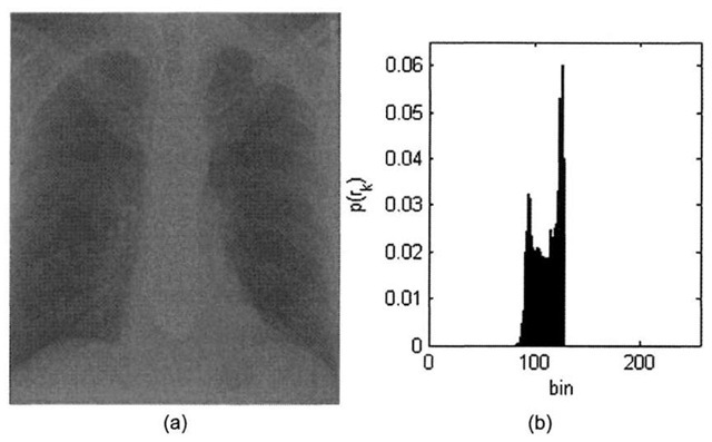  X-ray image courtesy of SRS-X, http://www.radiology.co.uk/srs-x. (a) Low contrast chest x-ray image, (b) Low contrast histogram. 