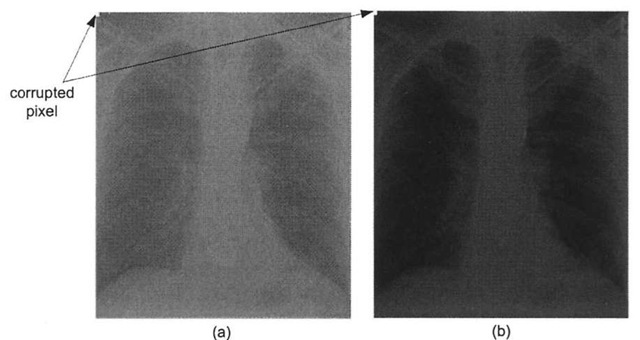  Noise reducing the effectiveness of contrast-stretching, (a) Corrupted low-contrast x-ray image, (b) The presence of the single noisy pixel prevents the scaling function from stretching the histogram. In fact, in this case it actually shrinks the histogram, thereby reducing the contrast! 
