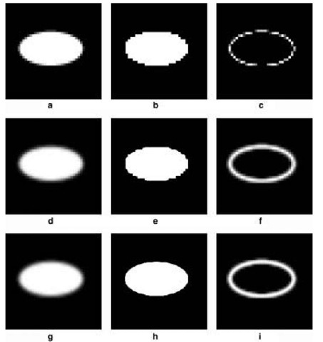 Experimental testing results based on the proposed sub-pixel interpolation method: (a) resampled image from experimental truth image (Figure 5.4c); (b) classification results based on resampled image; (c) entropy results of (b) (40 x 40 pixels); (d) probability image at the sub-pixel scale using central points of neighbouring pixels; (e)classification results at the sub-pixel scale based on (d); (f)entropy results of (e); (200 x 200 pixels); (g)probability image at the sub-pixel scale using the corners or edges of neighbouring pixels; (h) classification results at the sub-pixel scale based on (g); (i) entropy results of (h) (200 x 200 pixels) 