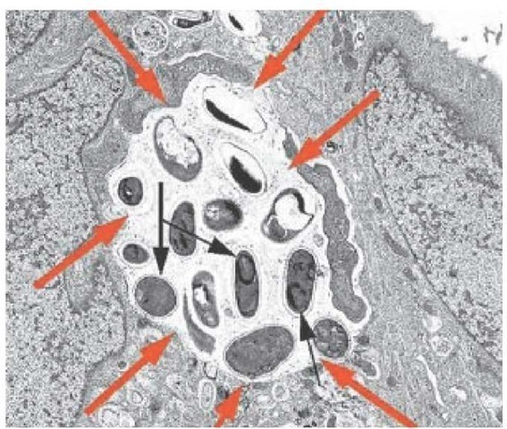 A transmission electron micrograph shows developing forms of Encephalitozoon intestinalis inside a parasitophorous vacuole (red arrows) with mature spores (black arrows).