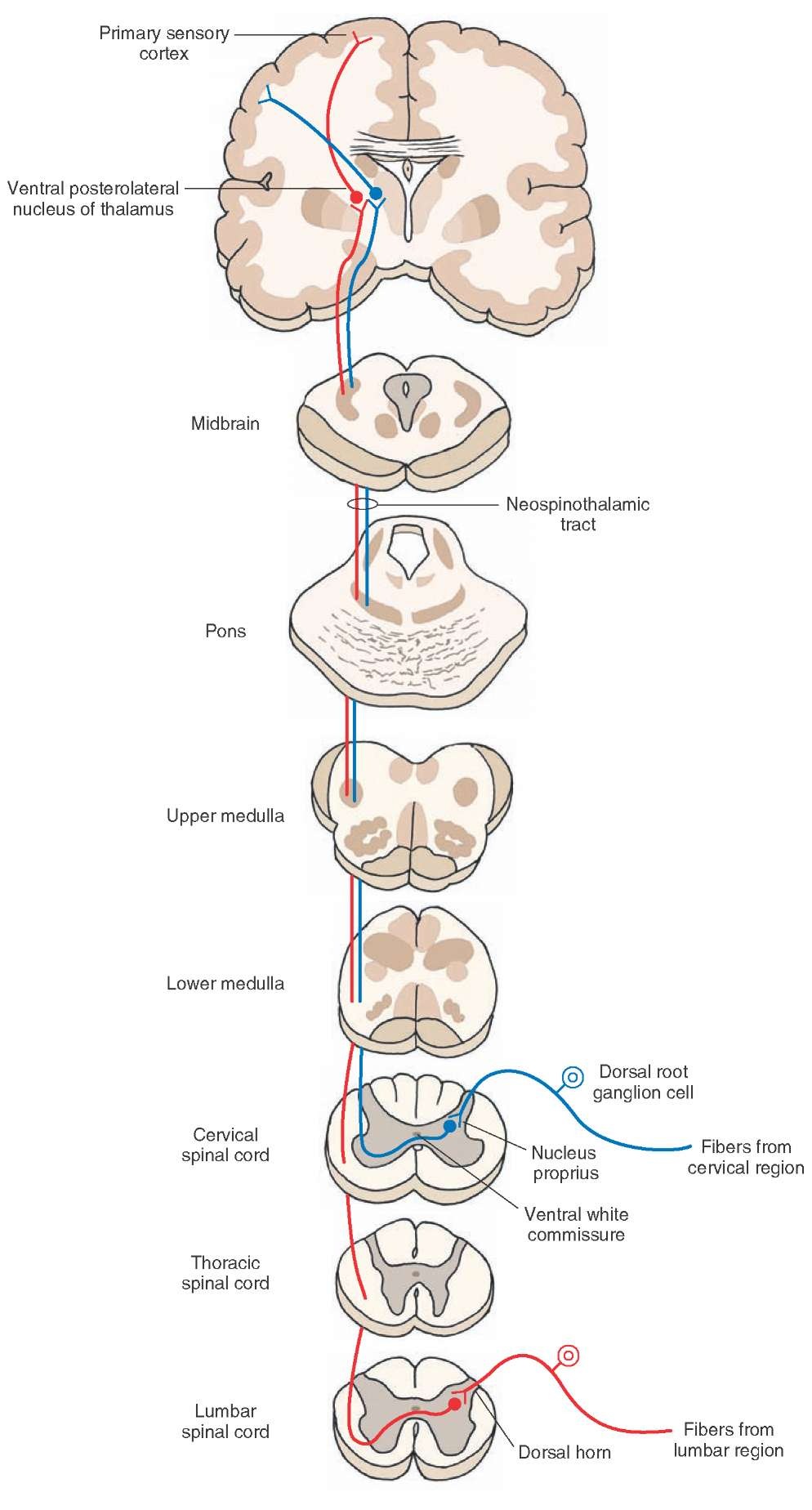 Direct spinothalamic pathway: the neospinothalamic tract. The peripheral processes of these dorsal root ganglion cells end as receptors sensing pain, temperature, and simple tactile sensations. The central processes of these dorsal root ganglion cells synapse with the neurons of the nucleus proprius. The axons of these second-order neurons cross via the anterior white commissure, enter the contralateral white matter, ascend in the lateral funiculus, and synapse on third-order neurons located in the ventral posterolateral nucleus of the thalamus. The axons of third-order neurons project to the primary sensory cortex. 