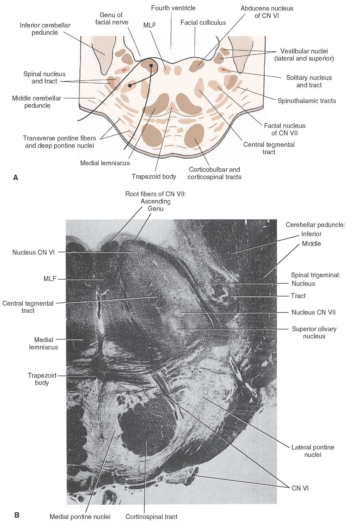  Caudal pons. (A) Cross section through the caudal aspect of the pons at the level of the facial colliculus of the pons. Note that the axons of cranial nerve (CN) VII pass dorsomedially around the dorsal aspect of the nucleus of CN VI, forming the facial colliculus, and then pass ventrolaterally to exit the brainstem. In contrast, the axons of CN VI pass ventrally to exit the brainstem in a relatively medial position. (B) Myelin-stained cross section through the caudal aspect of the pons. 