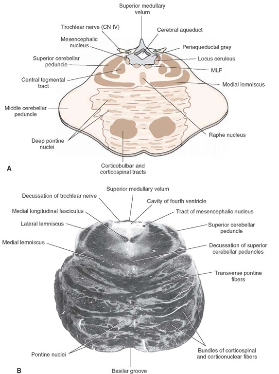  Rostral pons. (A) Diagram of a cross section through the upper pons at the level of the locus ceruleus and mesencephalic nucleus of the trigeminal nerve. CN = cranial nerve; MLF = medial longitudinal fasciculus. (B) Myelin-stained section through the same level of the pons as the level of the nucleus ceruleus and mesencephalic nucleus of the trigeminal nerve. 