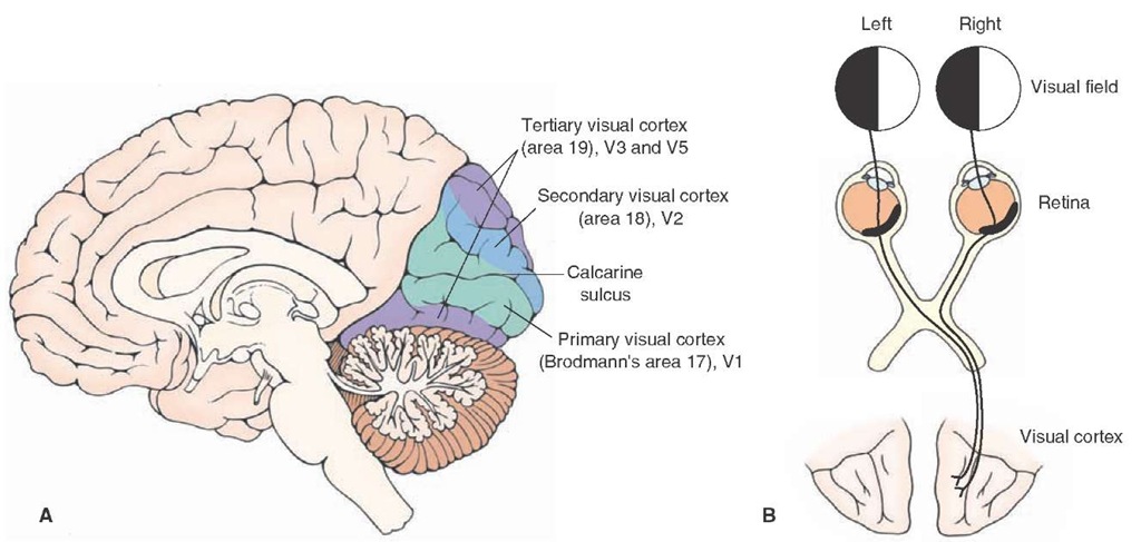 The visual cortex. (A) Note the location of the primary visual cortex ([V1] Brodmann's area 17), the secondary visual cortex ([V2] Brodmann's area 18), and the visual areas V3 and V5 (Brodmann's area 19). (B) Information from the nasal retina of the left eye and temporal retina of the right eye (representing the left visual field of both eyes) is directed to the right visual cortex. Likewise, information from the nasal retina of the right eye and temporal retina of the left eye (representing the right visual field of both eyes) is directed to the left visual cortex (not shown).
