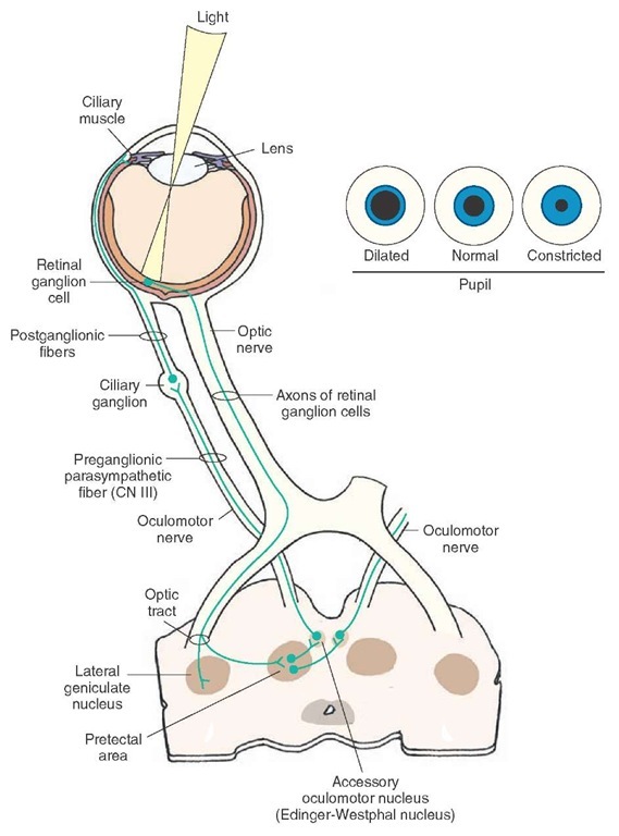 Pathways mediating the pupillary light reflex. The axons of the retinal ganglion cells project to the pretectal area. The neurons in the pretectal area send projections to the preganglionic parasympathetic neurons of the ipsilateral and contralateral Edinger-Westphal nuclei. The axons of the neurons in each Edinger-Westphal nucleus exit through the ipsilateral oculomotor nerve and project to the corresponding ciliary ganglion. The postganglionic fibers of the ciliary ganglion innervate the ciliary muscle.