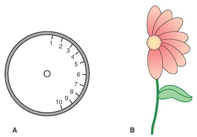 Drawings made by a patient with a lesion of the right posterior parietal cortex, indicating sensory neglect on the left side. The patient was asked to fill in numbers on the face of the clock (A) and to draw a flower (B).