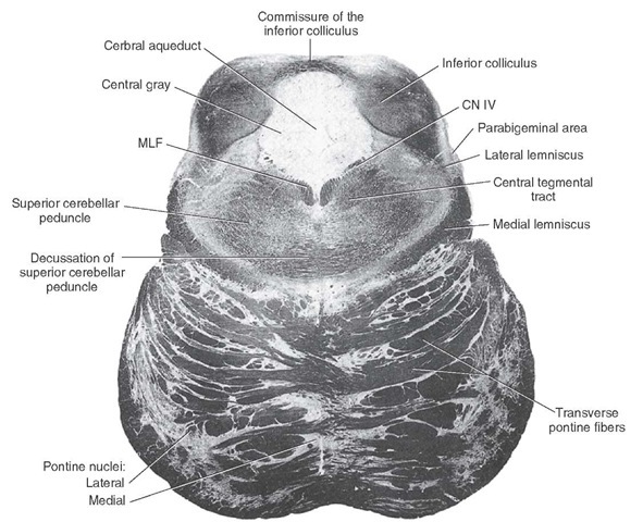 Photograph of a cross section taken at the level of the inferior colliculus (Weigert stain). MLF = medial longitudinal fasciculus; N.IV = cranial nerve IV.