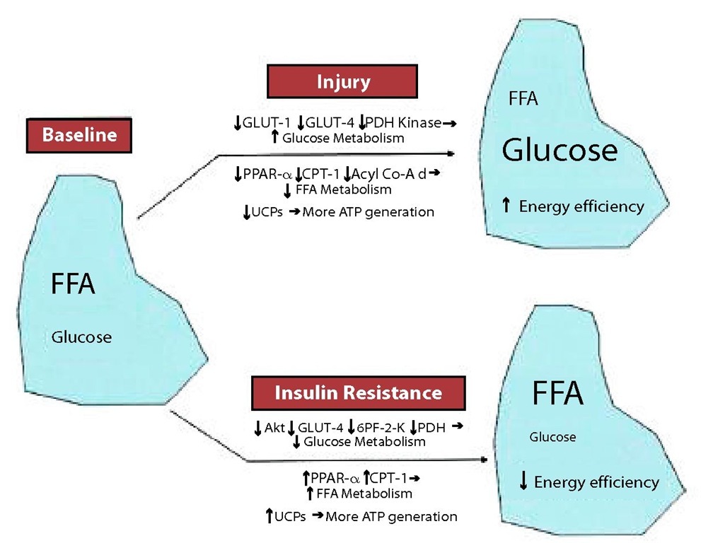 MYOCARDIAL ENERGY METABOLISM IN RESPONSE TO INJURY AND INSULIN RESISTANCE. FFA: free fatty acids; Acyl Co-A d: medium-chain acyl-coenzyme A dehydrogenase; CPT: carnitine palmitoyl transferase; GLUT: glucose transporter; PDH: pyruvate dehydrogenase; PPAR: peroxisome proliferator-activated receptor; UCP: uncoupling protein; 6PF-2K: 6-phosphofructo-2-kinase.