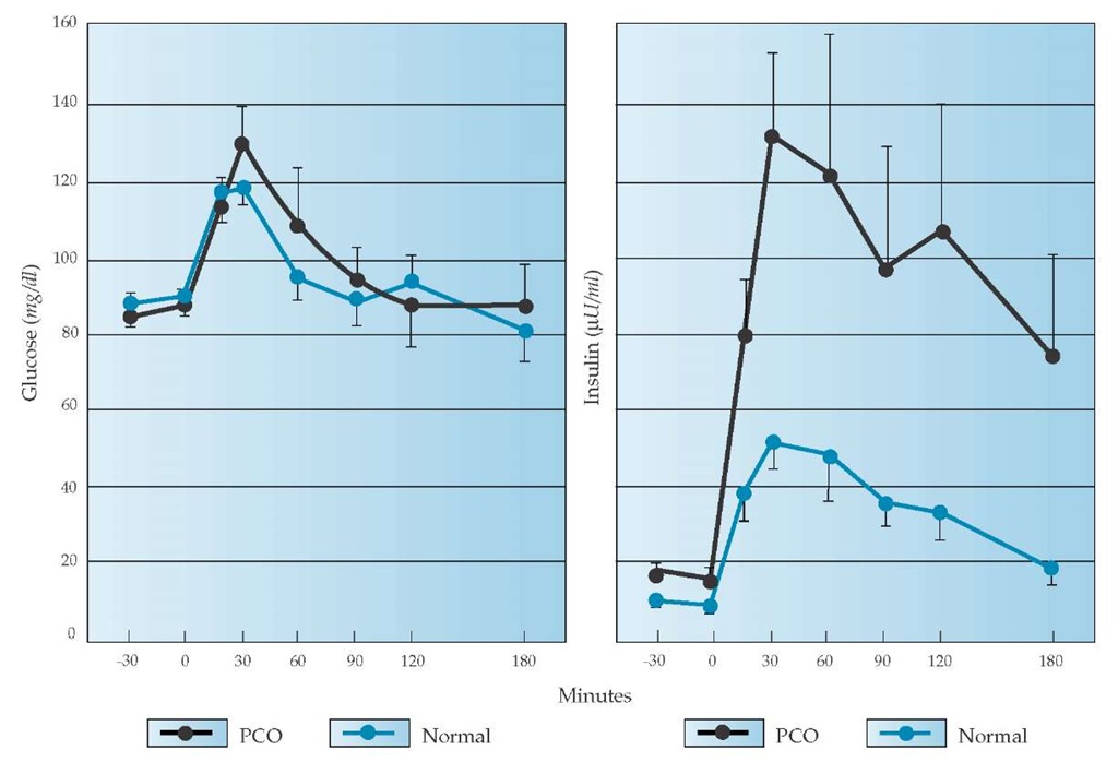 In response to an oral glucose challenge, nonobese women with PCOS experience an exaggerated increase in circulating insulin compared with weight-matched control subjects; the increase persists for over 3 hours.
