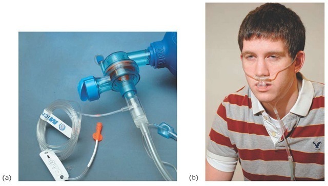  Mainstream versus sidestream sampling. (a) In mainstream capnography, the sensor is located between the endotracheal tube and the bag-mask assembly. (b) A modified nasal cannula is used to sample carbon dioxide from exhaled air. 