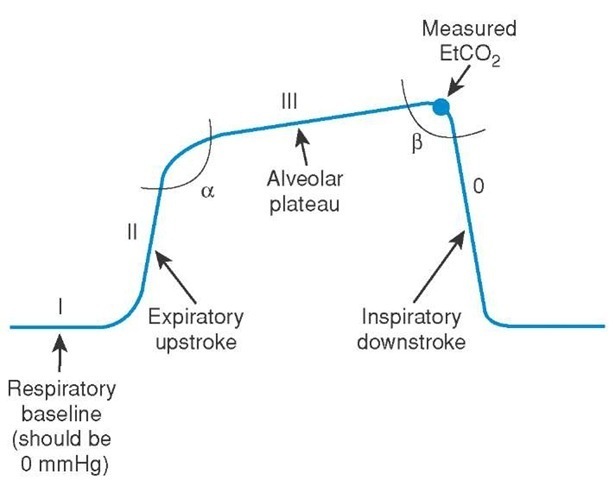 Anatomy of a typical end-tidal capnography waveform. 