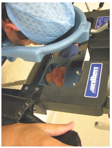 An example of a mirror system that allows inspection of the eyes and nose during surgery in the prone position.