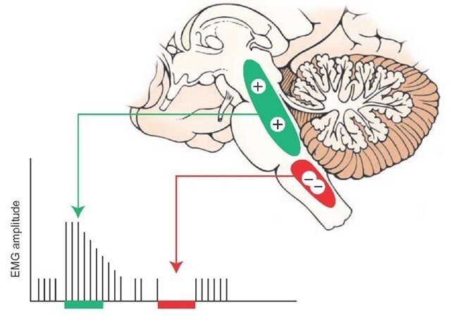 Effects of stimulation of reticular formation on spinal reflexes. Stimulation of the facil-itory zone ([+] shown in green) of the reticular formation causes a dramatic increase in the patellar reflex as determined by electromyographic (EMG) measurements, whereas marked suppression of this reflex follows stimulation of the inhibitory zone ([-] shown in red) of the reticular formation.