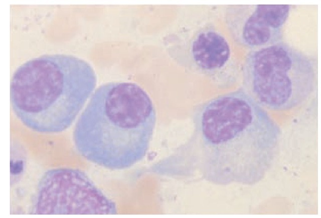 Plasma cells are the antibody-producing cells of the immune system. They differentiate from B cells; are 6 to 20 ^m in diameter; and have an eccentric nucleus, a highly basophilic cytoplasm, and a prominent, clear juxtanuclear area that contains the Golgi apparatus and the diplosome.