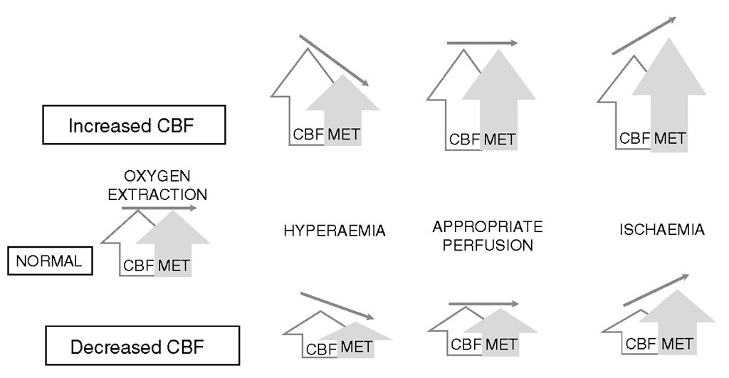 Relationship of cerebral blood flow (CBF) to the presence of ischaemia under conditions of varying metabolism. Changes in CBF levels compared with physiological levels may be misleading, as a diagnosis of ischaemia or hyperaemia demands that CBF levels be assessed in the context of metabolic requirements. MET, cerebral oxygen metabolism. 