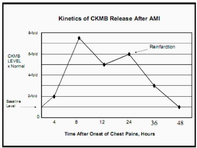 Kinetics of CKMB release after AMI 