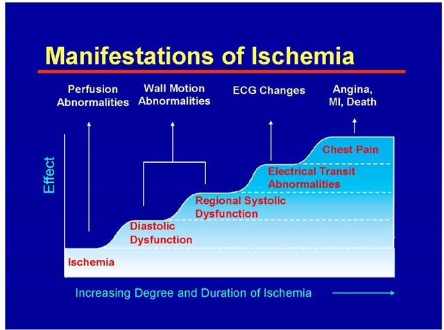 Manifestations of Ischemia