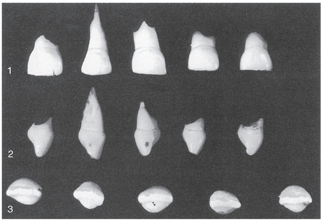 Primary maxillary central incisors (first incisors). 1, Labial aspect. Note the lack of character in the mold form; also note the mesiodistal width compared with the shorter crown length. A little of the crown length was lost through abrasion before the date of extraction. 2, Mesial aspect. The cervical ridges are quite prominent labially and lingually, with the bulge much greater than that found on permanent incisors. This characteristic is common to each primary tooth to a varied degree. Normally, these curvatures are covered by gingival tissue with epithelial attachment. 3, Incisal aspect.