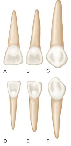 Primary right anterior teeth, lingual aspect. A, Maxillary central incisor. B, Maxillary lateral incisor. C, Maxillary canine. D, Mandibular central incisor. E, Mandibular lateral incisor. F, Mandibular canine.