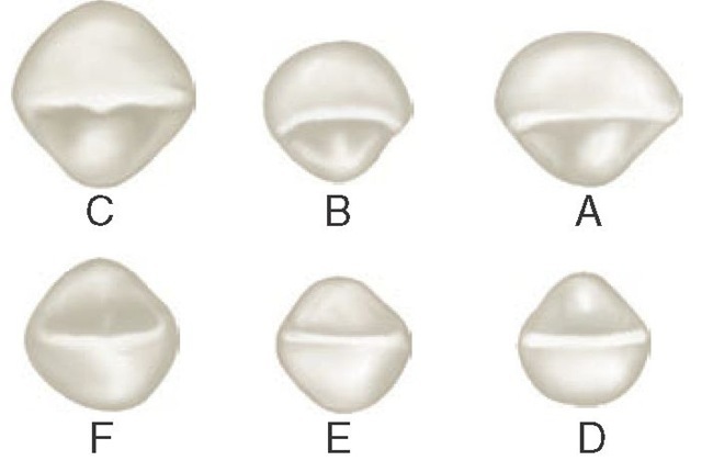 Primary right anterior teeth, incisal aspect. A, Maxillary central incisor. B, Maxillary lateral incisor. C, Maxillary canine. D, Mandibular central incisor. E, Mandibular lateral incisor. F, Mandibular canine.