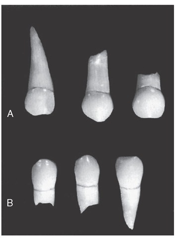 A comparison of primary canines, both in the size and shape of the crowns. Two of them have their roots intact and show no dissolution. A, Maxillary canines. B, Mandibular canines. Compare Figures 3-16 and 3-20.