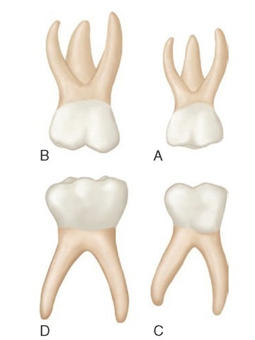 Primary right molars, buccal aspect. A, Maxillary first molar. B, Maxillary second molar. C, Mandibular first molar. D, Mandibular second molar.