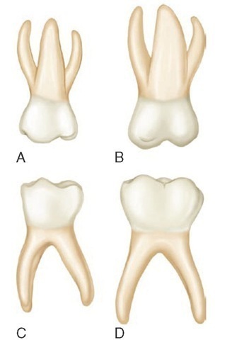 Primary right molars, lingual aspect. A, Maxillary first molar. B, Maxillary second molar. C, Mandibular first molar. D, Mandibular second molar.