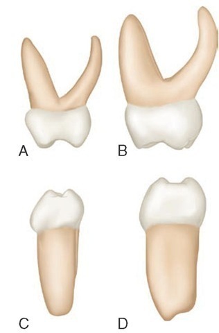 Primary right molars, mesial aspect. A, Maxillary first molar. B, Maxillary second molar. C, Mandibular first molar. D, Mandibular second molar.