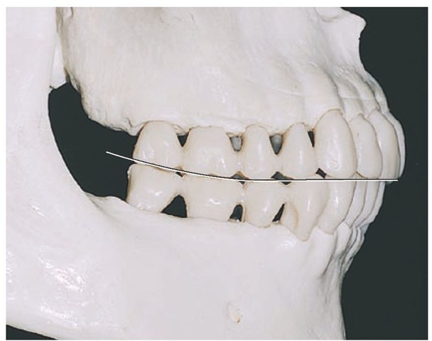  Teeth are in the intercuspal position (ICP) or centric occlusion (CO). The curved line is the curve of Spee.