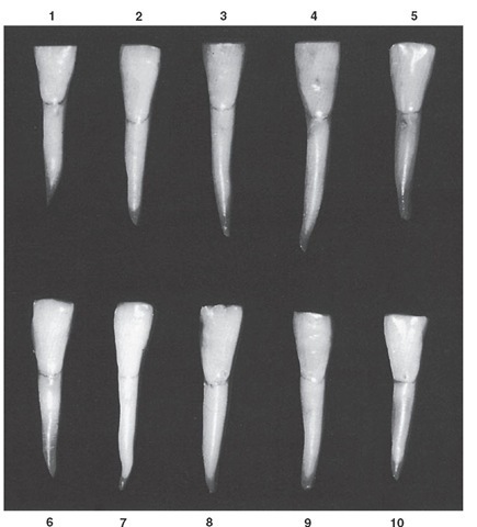 Mandibular central incisor, labial aspect. Ten typical specimens are shown.