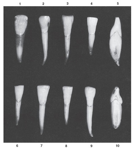 Mandibular central incisor. Ten specimens with uncommon variations are shown. 1, Crown and root very broad mesiodistally; malformed enamel at incisal third of crown. 2, Crown wide at incisal third, with short crown; root length extreme. 3, Unusual contours at middle third of crown; cervix narrow. 4, Well-formed crown; short root. 5, No curvature labially at cervical third; extreme labial curvature at root end. 6, Specimen well formed but undersized. 7, Contact areas pointed at incisal edge; crown and root very long. 8, Crown long and narrow; root short. 9, Crown measurement at cervical third same as root; crown and root of extreme length. 10, Crown and root very wide labiolingually; greater curvature than average above cervical line at the cervical third of the crown.